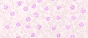 CDI Roundtable: Advancing Quality Through CDI – A Focus on Mortality and PSI Reviews